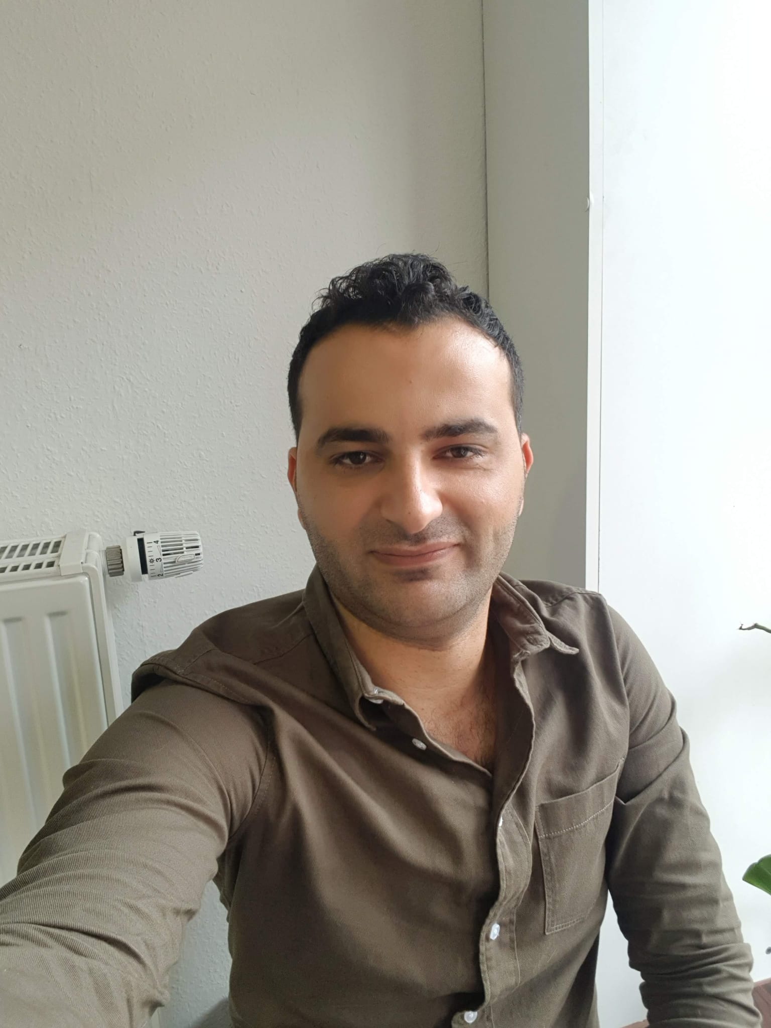 حالة 9 قبل زراعة الشعر